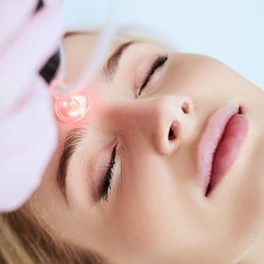 Monthly Laser Facial Membership at Michelin Beauty Studio in Brooklyn, NY
